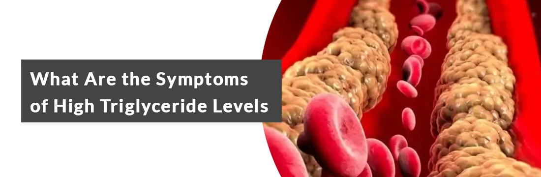 What Are the Symptoms of High Triglyceride Levels